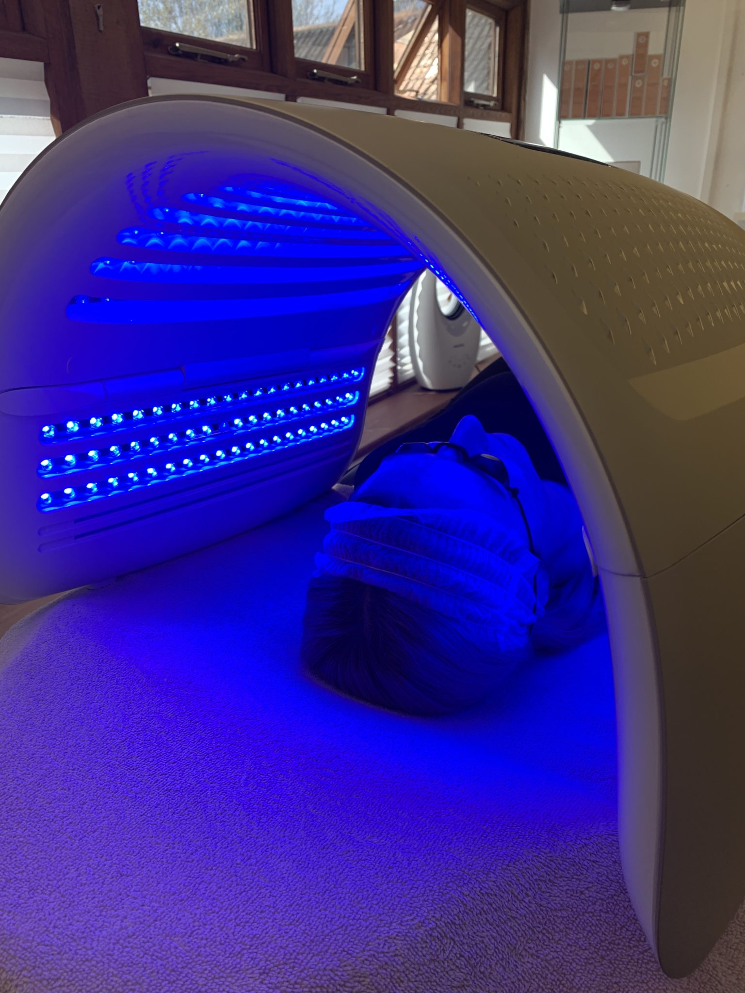 Opatra LED Light Therapy Treatment Finesse Skin Clinic