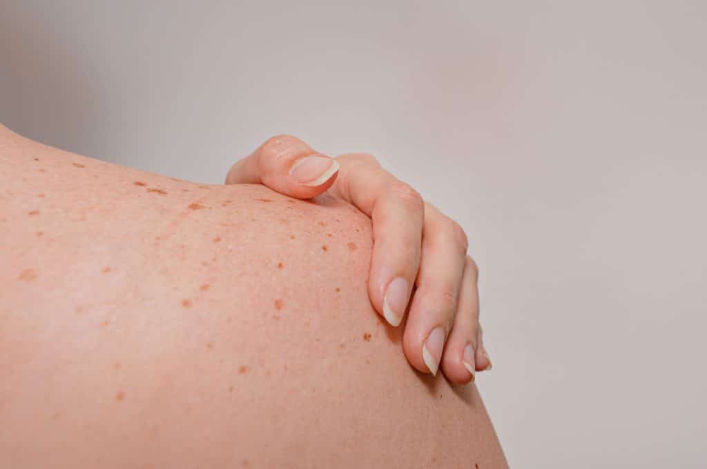 Skin lesion checking service at Finesse Skin Clinic