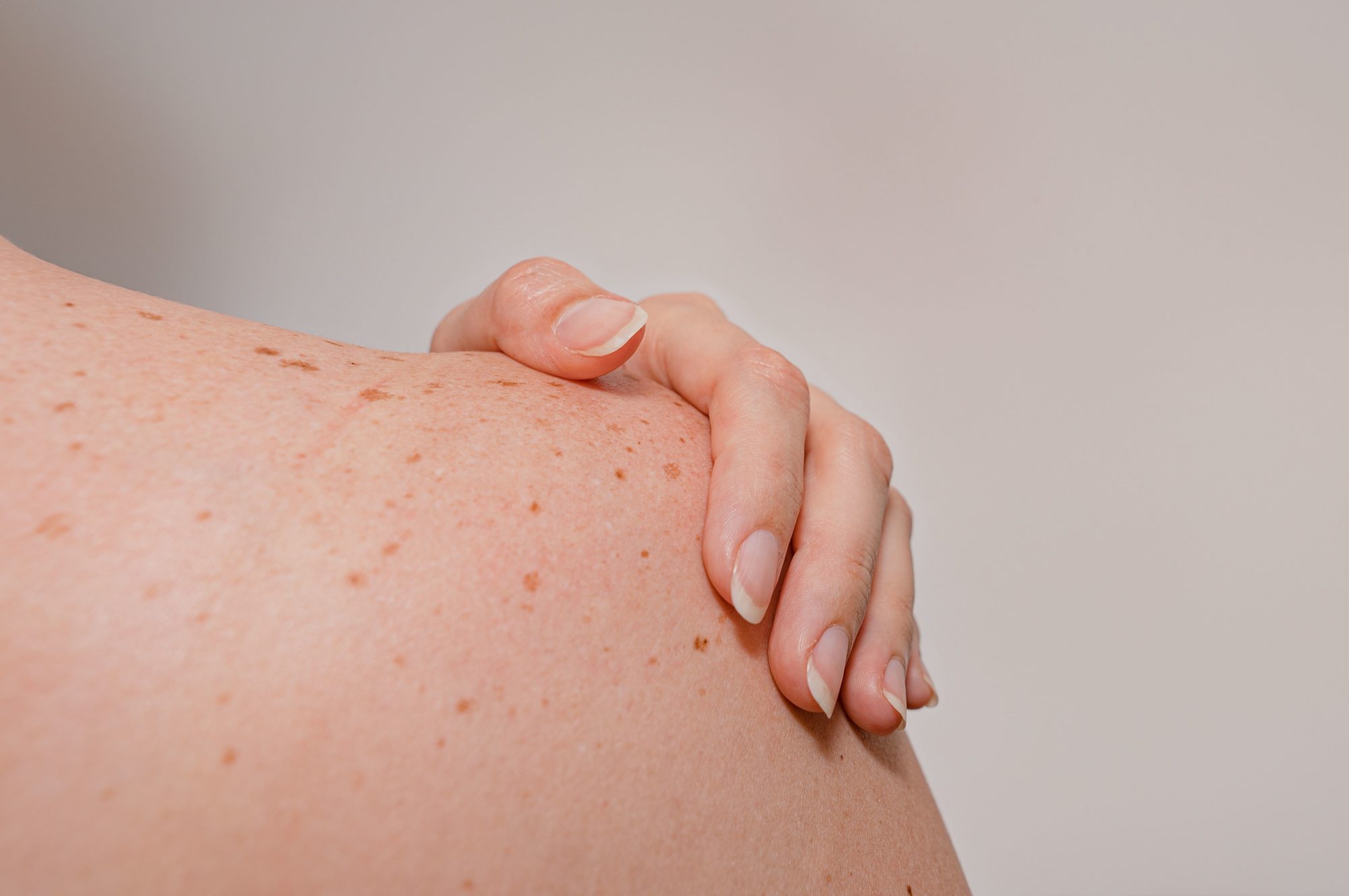 Skin lesion checking service at Finesse Skin Clinic