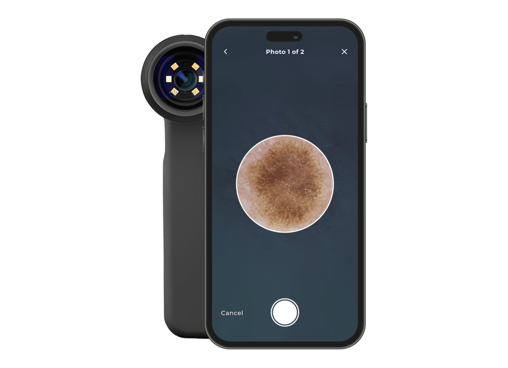 Clinical Grade Pharma scope for assessing skin lesions