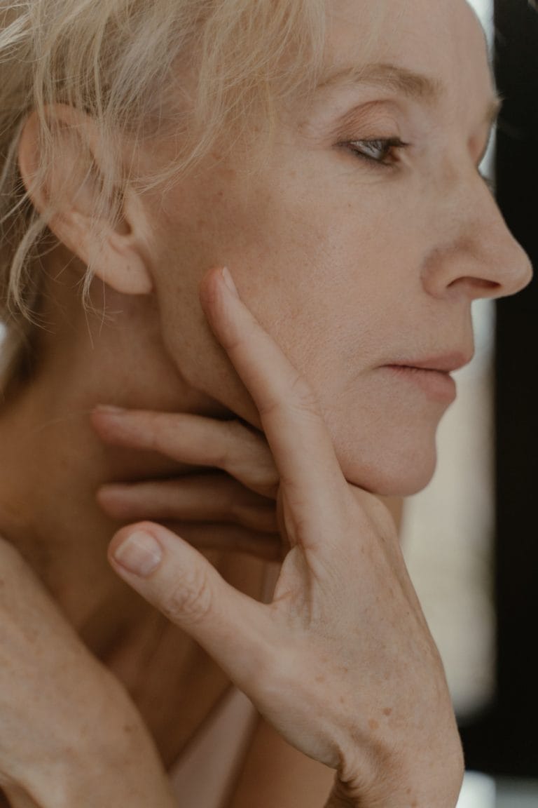 Woman showing facial pigmentation and sun damage before skin treatment